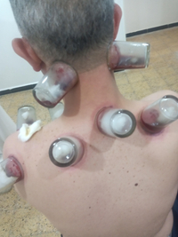 الجزائر-عين-بنيان-طب-و-صحة-medecine-parallele